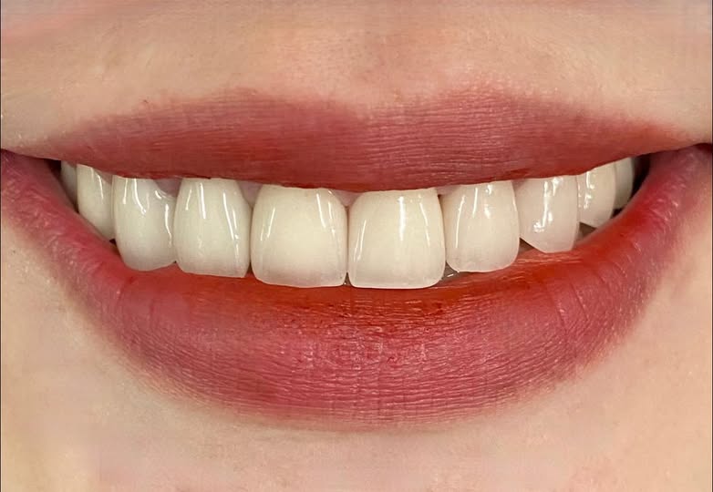 Nha khoa Nhà Đỏ TUYỂN DỤNG: Phụ điều trị: 1