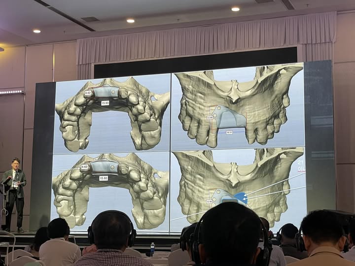 NHA KHOA GIA ĐÌNH 2 GHẾ TUYỂN ĐIỀU TRỊ: