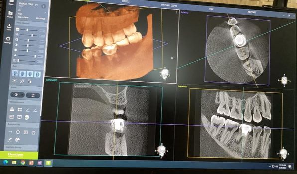 Cần tuyển bác sĩ, y sĩ Có kinh nghiệm