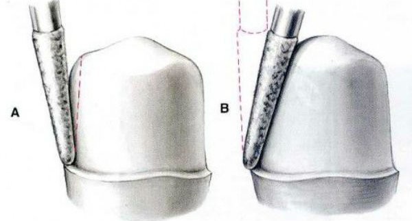 Nam ys rhm ( 6 năm kn) chuyên sứ thẩm mỹ, tổng quát, chỉnh nha