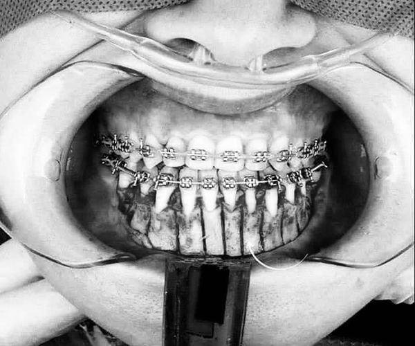 tuyển dụng PHỤ TÁ ( số lượng 03 nữ)