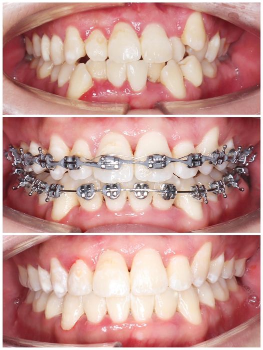 TUYỂN DỤNG BÁC SĨ CHUYÊN NIỀNG RĂNG