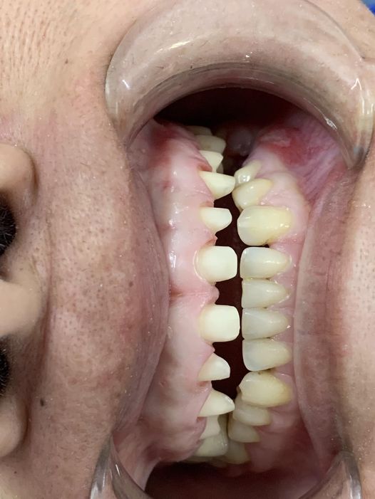 Nam 30t , muốn tìm việc kv tp bmt ạ 