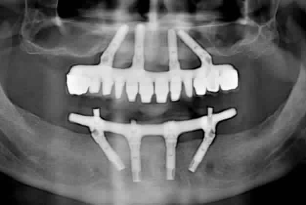 mong muốn tìm việc điều trị, đứng ghế tại khu vực TPHCM