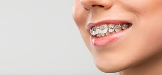 Em có cchn 18 tháng sở y tế Hà Nội cấp và cc chỉnh nha đại học y Hà Nội cấp.