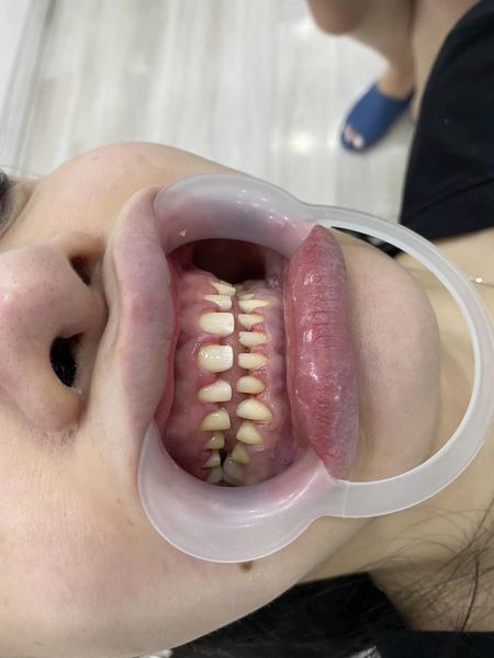 Mình là nam 29 tuổi, kinh nhiệm 7 năm