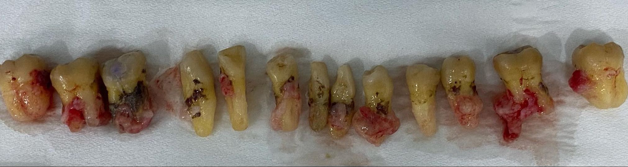 Em nam ysdk đã có chứng chỉ ysRHM. Em tìm công việc phụ điều trị hoặc phụ tá
