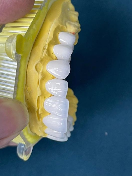 Em là nam 29 tuổi ysrhm hiện em đang học lên tiếp tại ĐHYD Buôn Mê Thuột