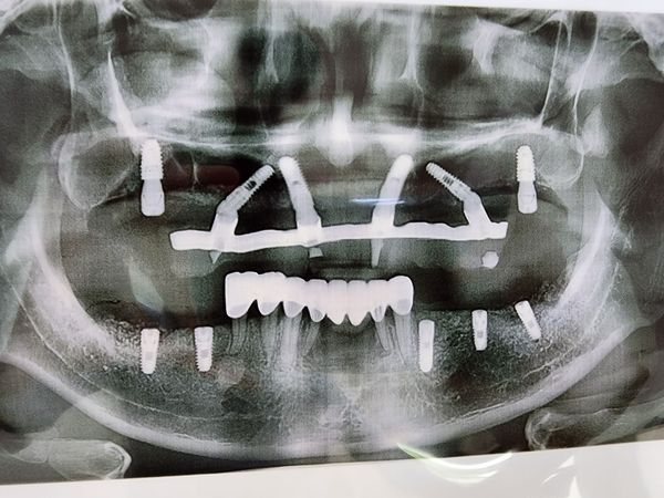 Bs.CKI RHM tốt nghiệp Đh Y dược TPHCM 