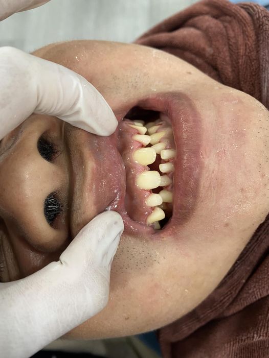 Em là nam 28 tuổi muốn tìm công việc mài thẩm mỹ tại hà nội