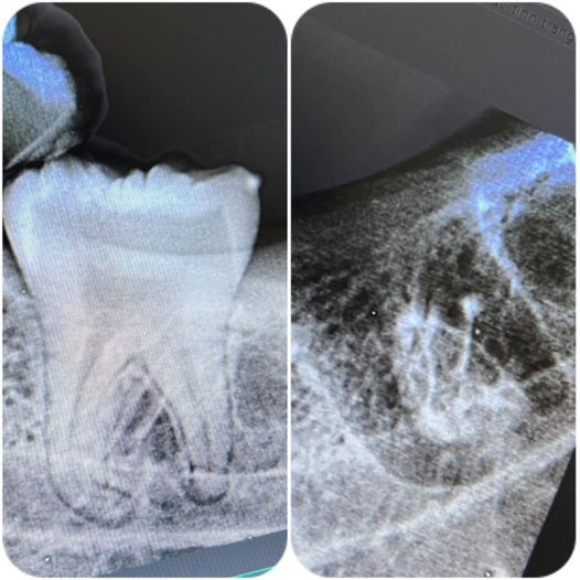 Nha khoa tại Buôn Ma Thuột cần tuyển  - 2 phụ tá