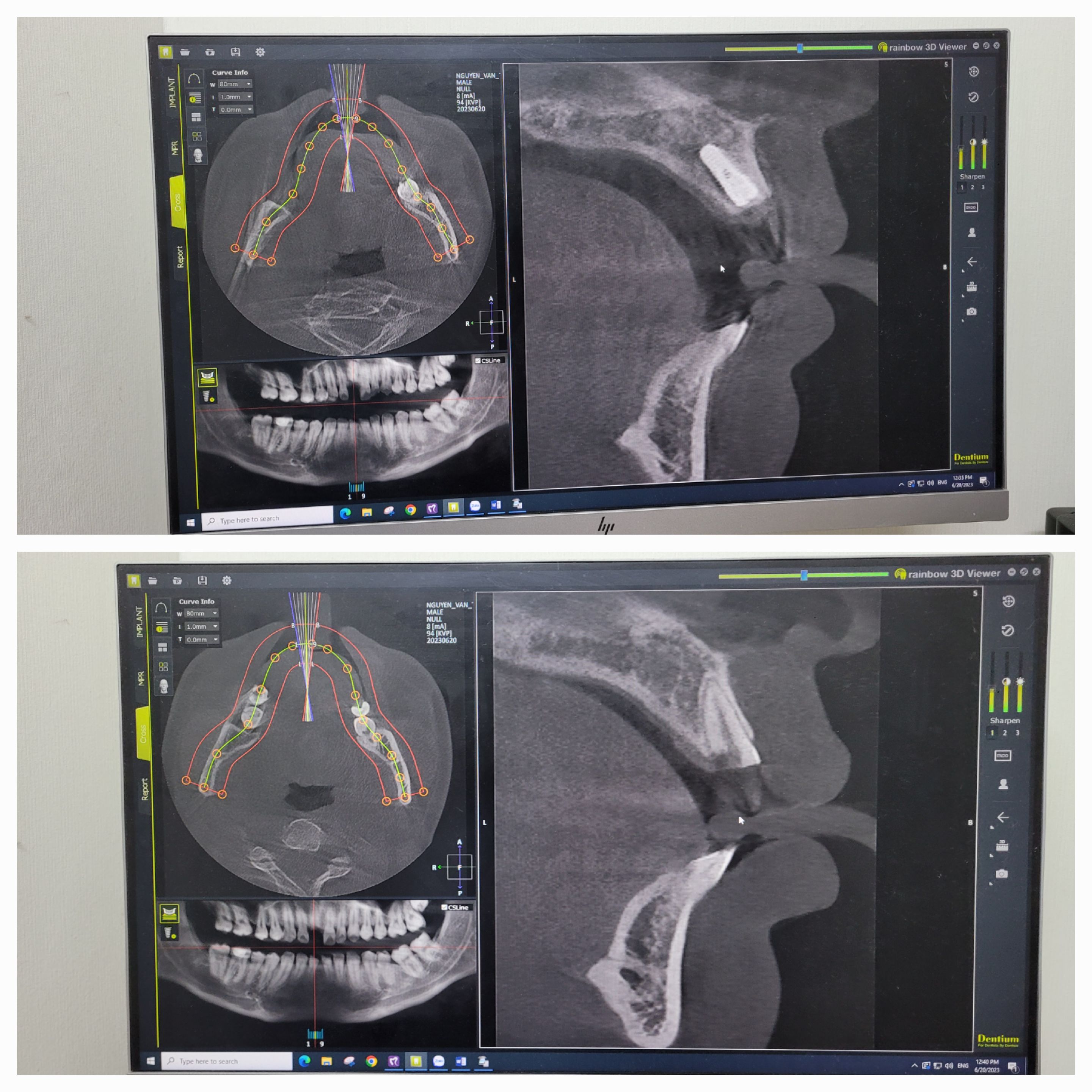Em YsRHM 5 năm Kinh nghiệm cần xin Công Việc Điều Trị ạ.