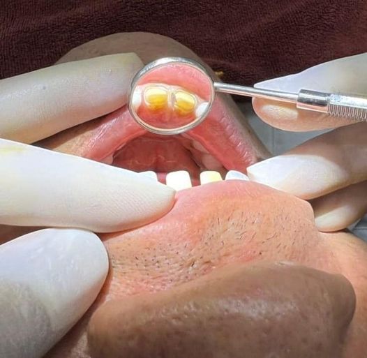 Em ứng tuyển vị trí phụ điều trị