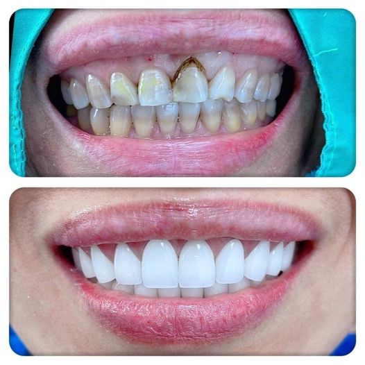 Cần tuyển phụ tá nữ. ( thủ Đức)