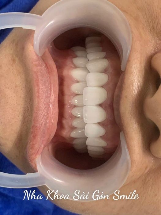 👻 Nha Khoa Sài Gòn Smile Suối Nghệ cần tuyển phụ tá gấp(nam hoặc nữ, y sĩ, điều dưỡng.)