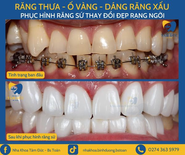 Nha khoa tâm đức Bs Toàn tại bình dương cần tuyển   Phụ điều trị - điều trị 