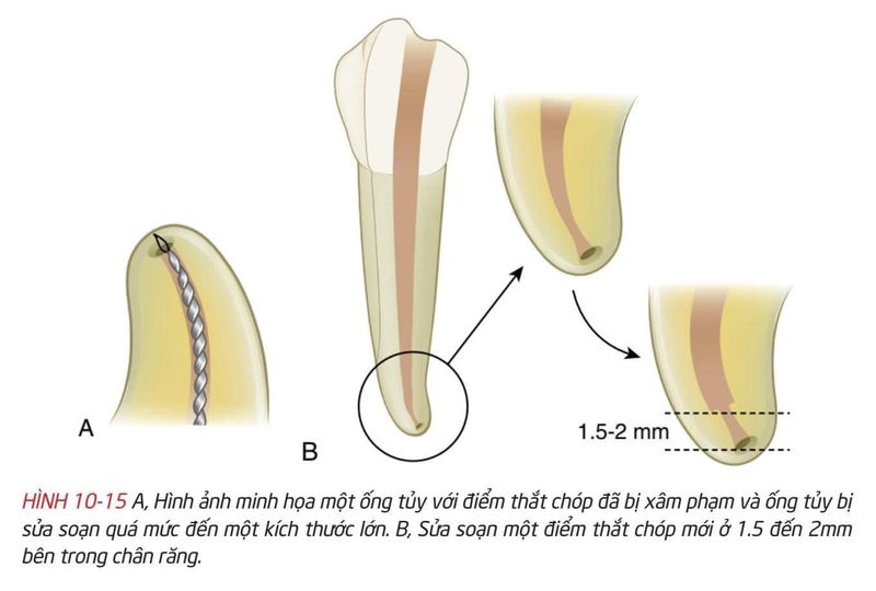 Nam YSRHM tìm việc điều trị