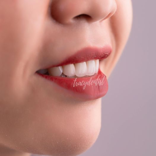 Tuyển gấp 3 phụ tá nha khoa làm việc tại quận 11