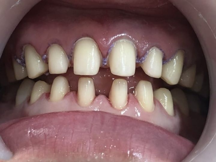  Nha khoa khu vực sài gòn tuyển dụng  Bs cắm implant  80-200tr Bs mài thẩm mỹ 50-150tr Phụ tá nha khoa 7-15tr