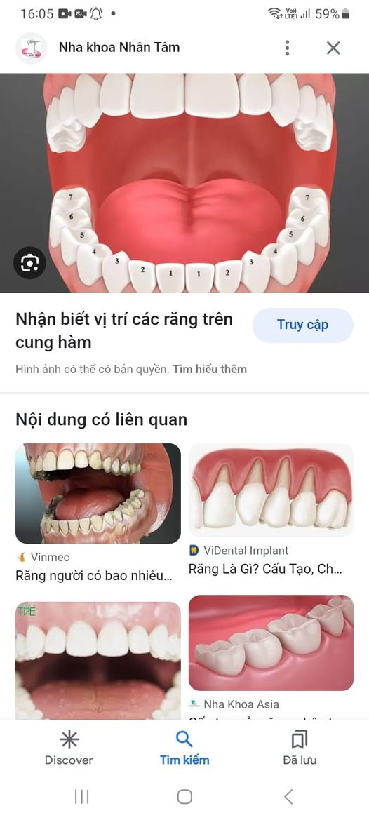  E nam ysđk 25t biết cạo vôi trám răng, điều trị tủy