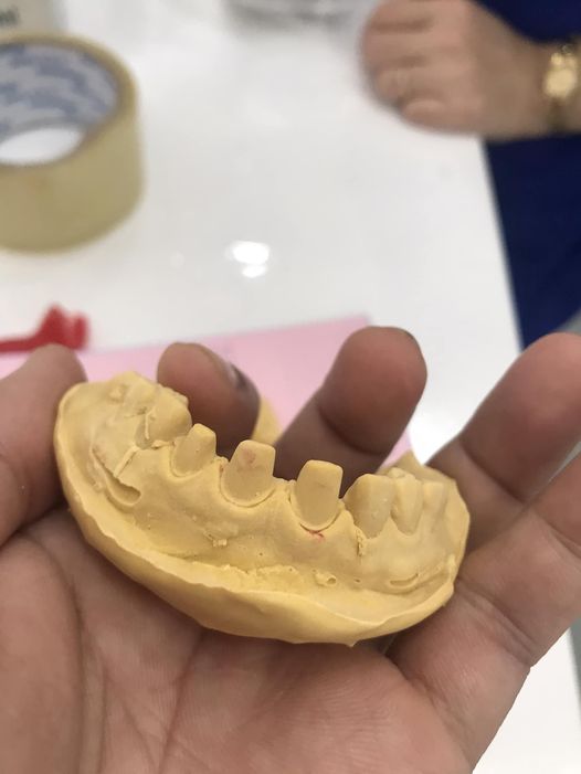 Nam 27 tuổi ys-ysrhm tìm việc tp Thủ Đức Điều trị tổng quát - nội nha tay- máy- phcđ -phtl- mài veener đơn lẻ- toàn hàm