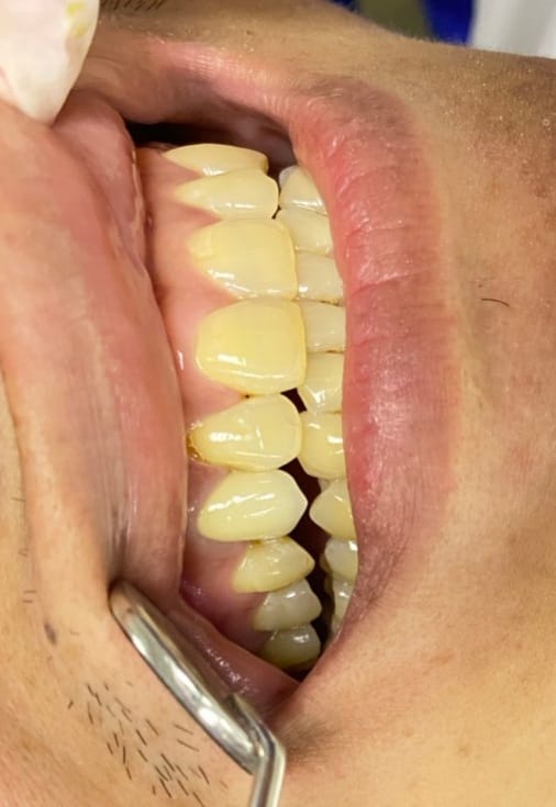 Chào quý nha khoa! E là nam ysrhm 33t, có kinh nghiệm hơn 6 năm làm tổng quát