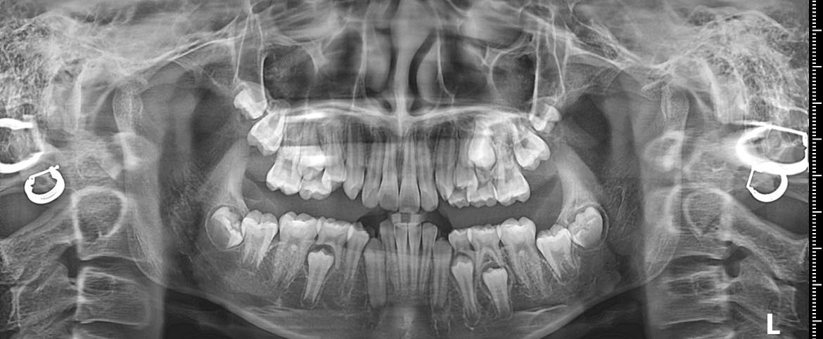 Nha Khoa Hoà Việt Mỹ CẦN TUYỂN: 