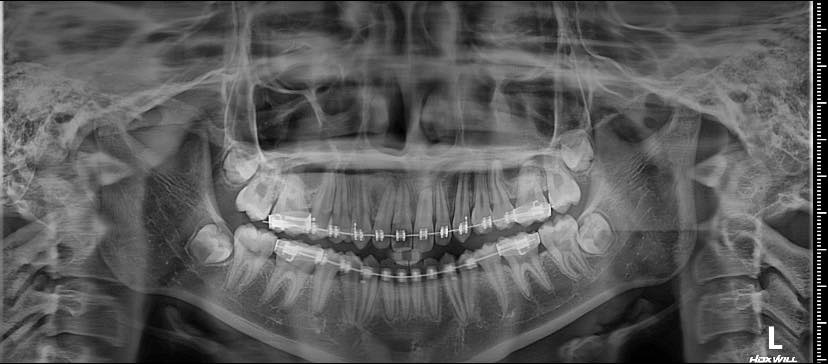 Xin phép admin. khu vực tp buôn mê thuật và huyện cưgmar có nha khoa nào tuyển nhân sự làm part time  không ạ