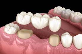 Em là nam, 34 tuổi y sĩ răng hàm mặt, làm cứng tất cả các thủ thuật, trừ implan và chỉnh nha (tư vấn tốt impan và chỉnh nha)