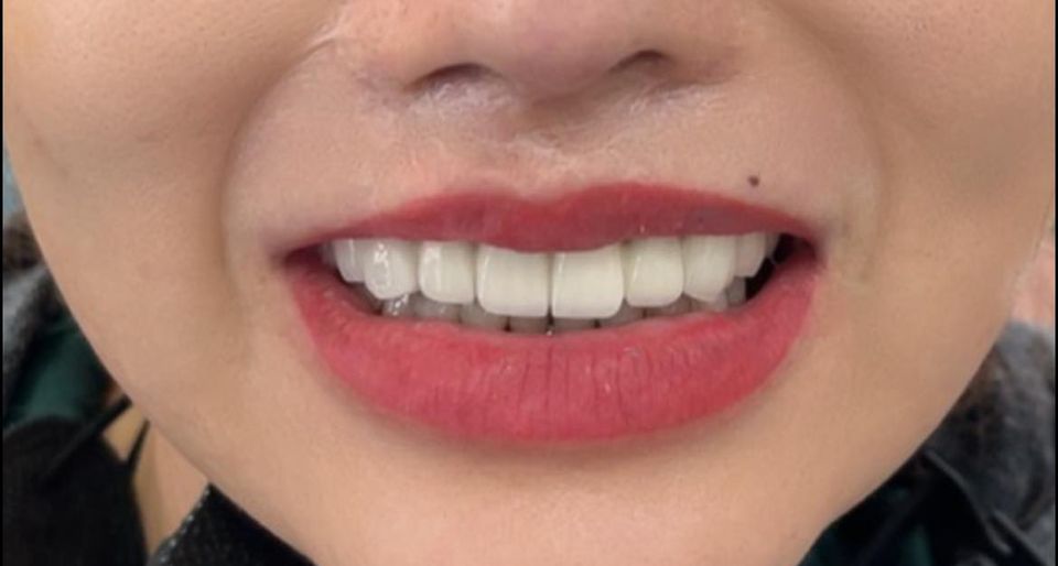 Em là nữ  sinh năm 1992 Y Sĩ Đa Khoa định hướng Chuyên Khoa Nha 