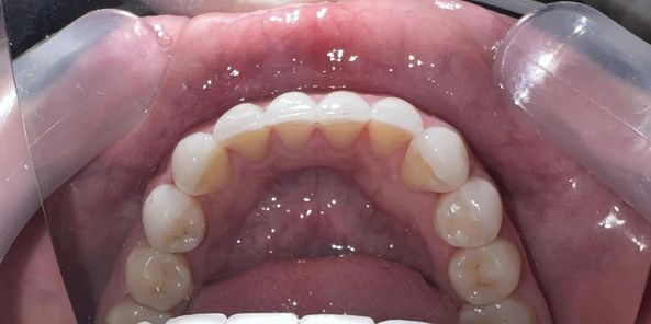 Em là nam, hiện tại em là Ysĩ đa khoa và Điều dưỡng nha khoa, em có kinh nghiệm 8 năm trong nghề