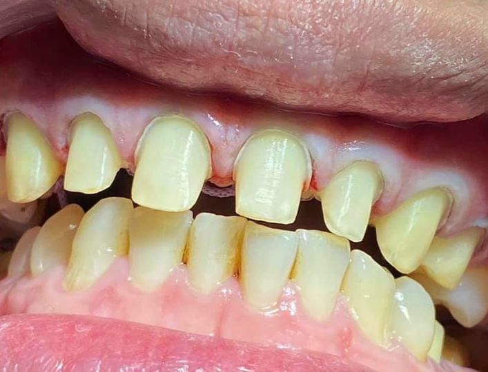 Mình là nam 32t Y Sĩ Đa Khoa có 10 năm kn điều trị, đứng ghế độc lập