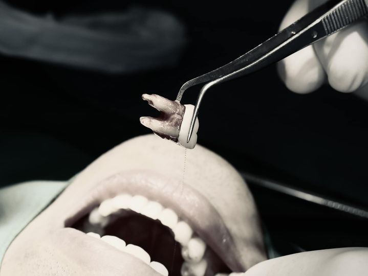 TUYỂN DỤNG ĐI LÀM NGAY🎁 Địa Điểm: QUẬN BÌNH TÂN 🦷 Bác sĩ RHM: 02 người 🦷 Y sĩ RHM: 02 người