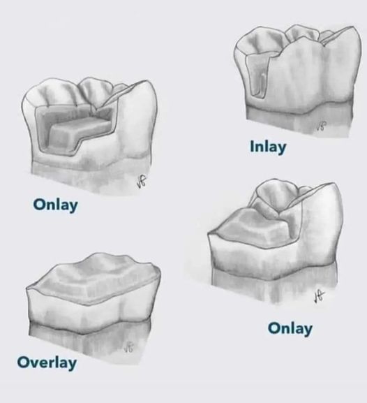 Nam YSRHM tìm việc điều trị