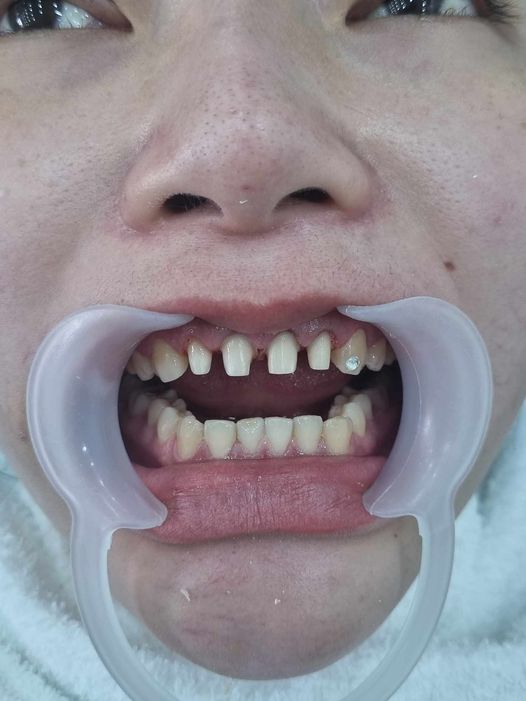 E là nam có kinh nghiệm được 3 năm,e muốn xin làm điều trị 