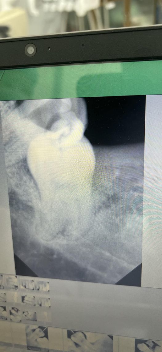 Cần tuyển vi trí  Đúng phòng: lương 20-50 Điều trị: luong 12-17