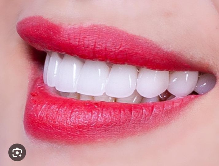 NHA KHOA KHU VỰC BÌNH DƯƠNG CẦN TUYỂN 👉Tuyển 2 bạn phụ tá làm nha khoa .