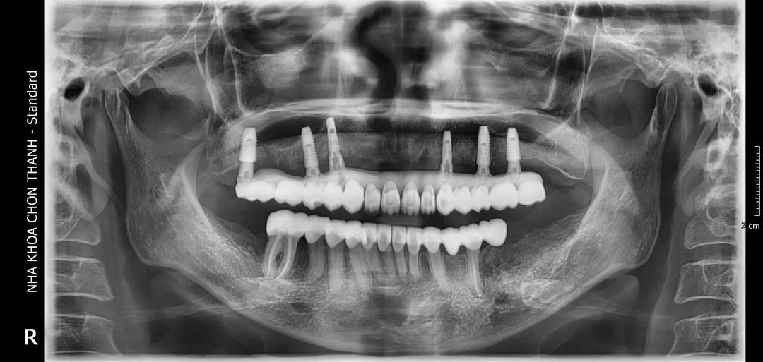 CẦN TUYỂN Y BÁC SỸ RĂNG HÀM MẶT  -Yêu cầu kinh nghiệm trên 3 năm