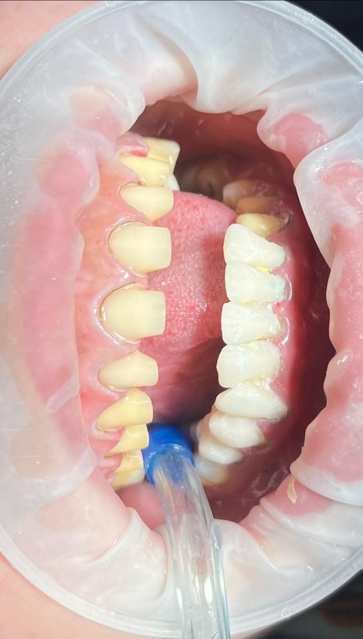 Em nam ysdk kinh nghiệm 4 năm đứng ghế