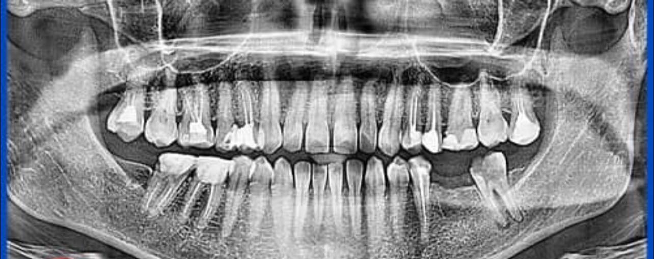 Mình là nam y sỹ muốn xin điều trị,kiếm một nha khoa có thể gắn bó lâu dài