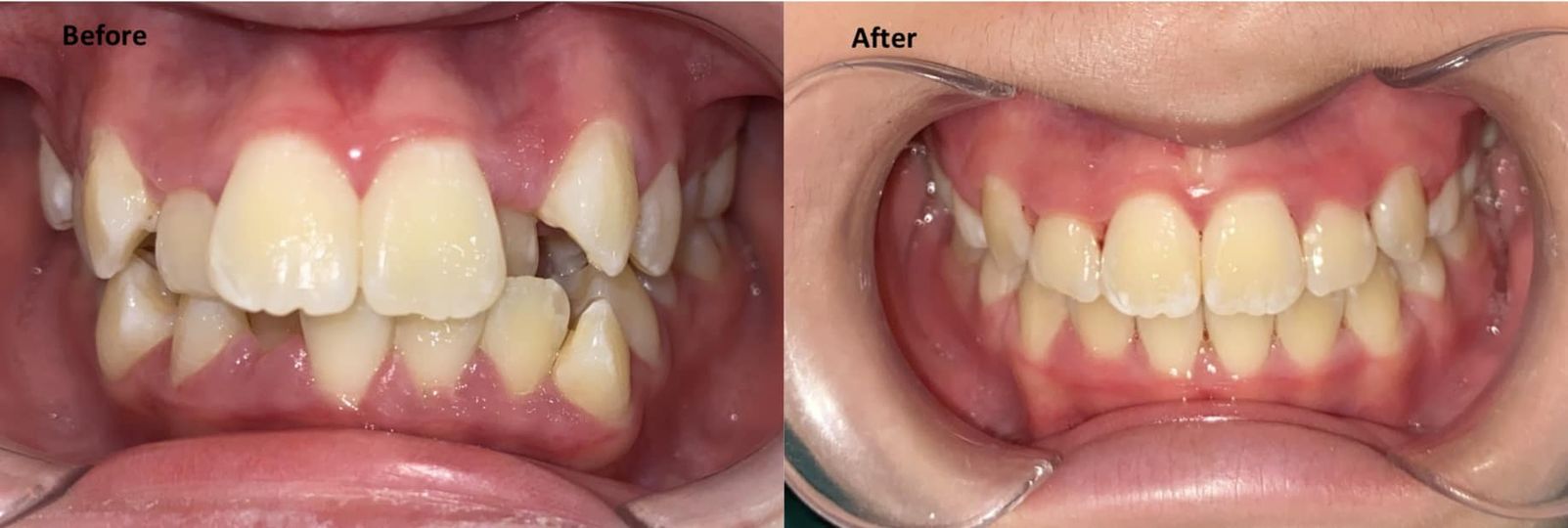 Mình là bác sĩ có chứng chỉ chỉnh nha sở y tế HCM và các khoá ngắn hạn