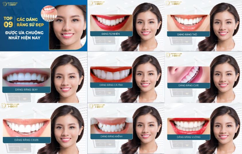 NHA KHOA IDENT CẦN HỢP TÁC BS NHA CHUYÊN SỨ THẨM MỸ (FULLTIME)