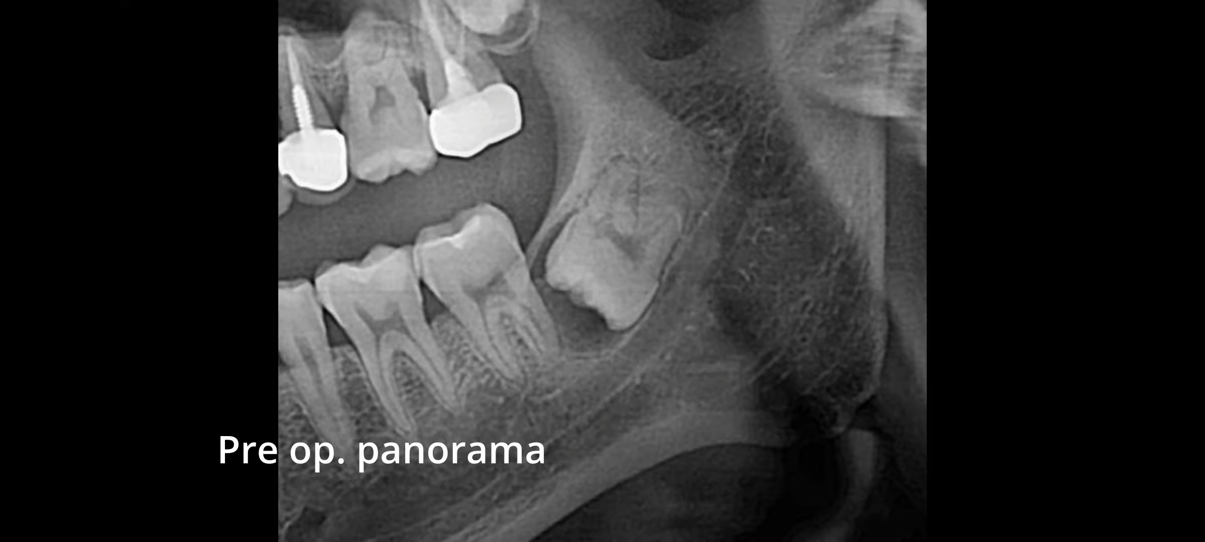 Em bác sĩ răng hàm mặt đại học y dược tphcm, do đi thực tập để lấy 18 tháng,nên cần kiếm phòng khám làm parttime ngoài giờ hành chính, nếu hợp thì gắn bó lâu dài sau này,cảm ơn. 