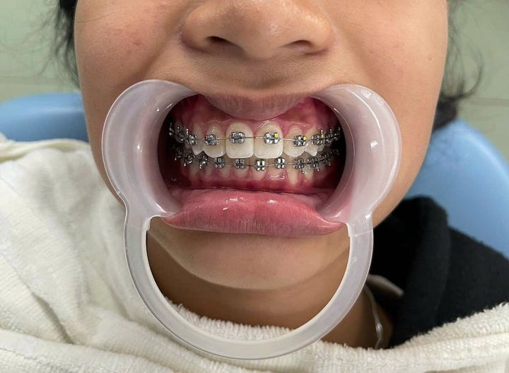 Cần tuyển 2 bạn điều trị có tay nghề tôt ,làm viêc tại khánh hòa