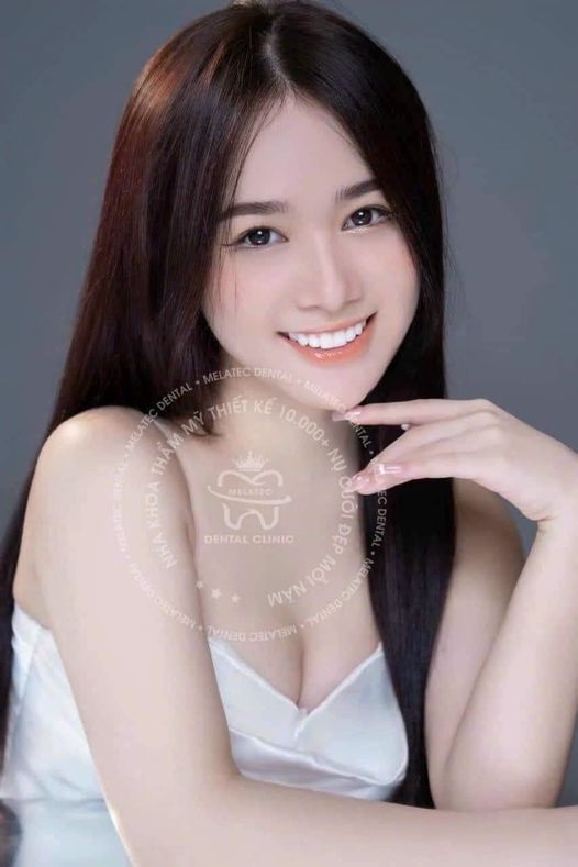 Nha Khoa Melatec hà nội cần tuyển gấp các vị trí sau: