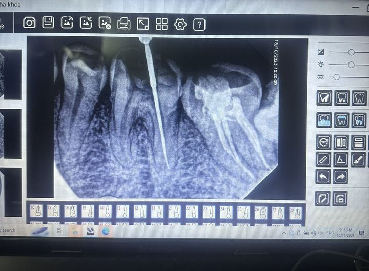 CẦN TÌM 1 BẠN ĐIỀU TRỊ KIÊM ĐỨNG PHÒNG Ở HÀ TĨNH