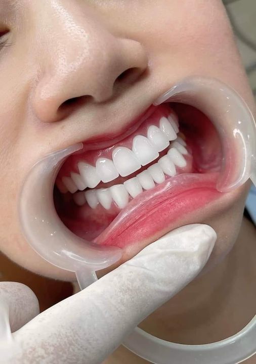 ❤️Nha khoa Nhật Minh cần tuyển :