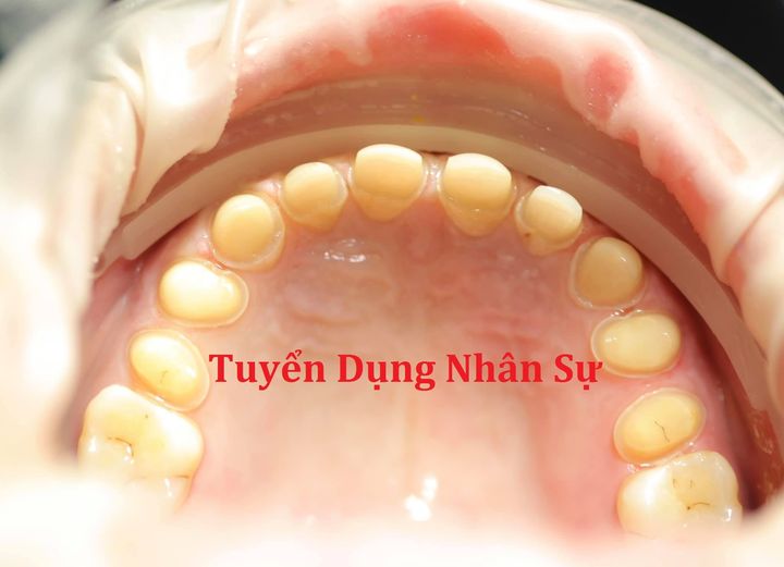 Chúng tôi cần tuyển ĐIỀU TRỊ