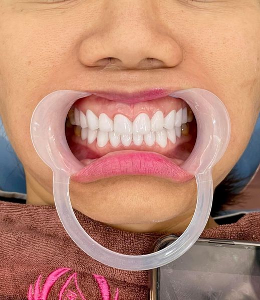 Tuyển dụng nhân sự nha khoa Vị trí: Điều trị( bằng cấp ngành y dược hoặc kh có ib)