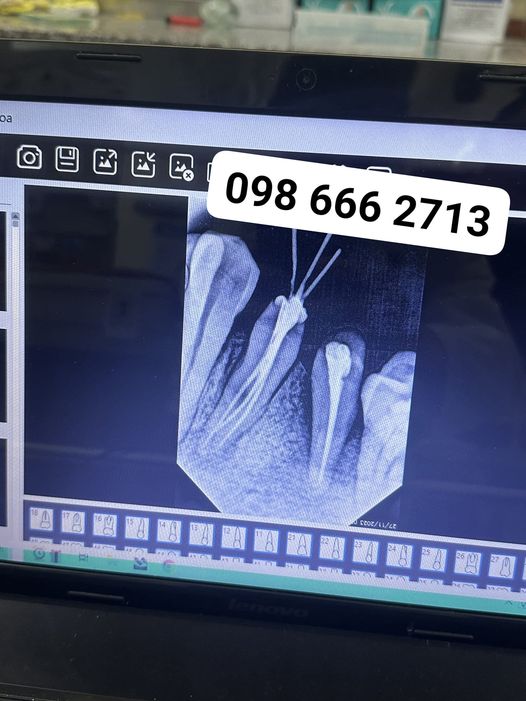 cần tuyển gấp trợ thủ có thể cvr, tẩy trắng, trám, nhổ răng sữa